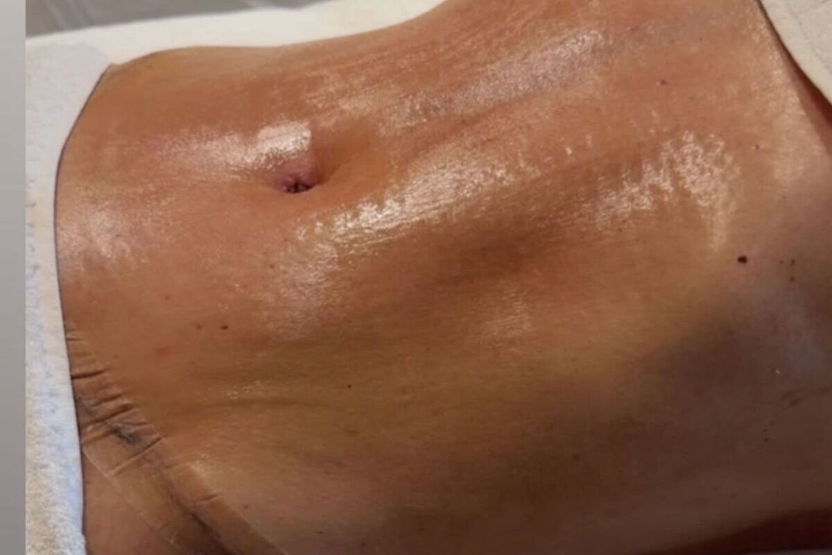 Cirurgia de Margareth Serrão (Fonte: Instagram)