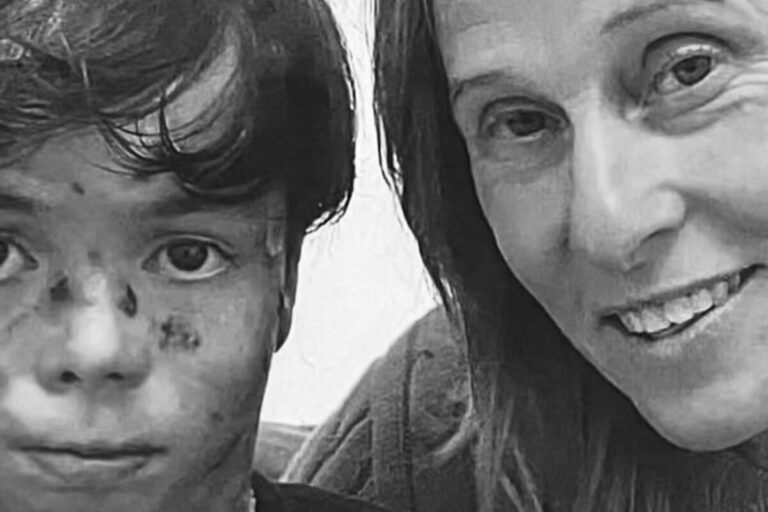 Morre neto de Deborah Colker aos 14 anos após condição rara: “nosso guerreiro”