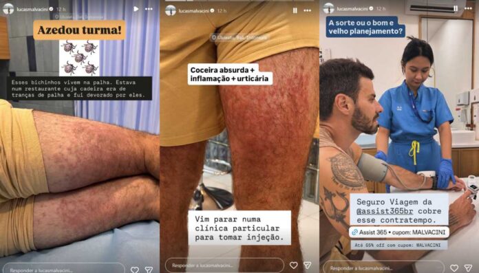 Post Lucas Malvacini