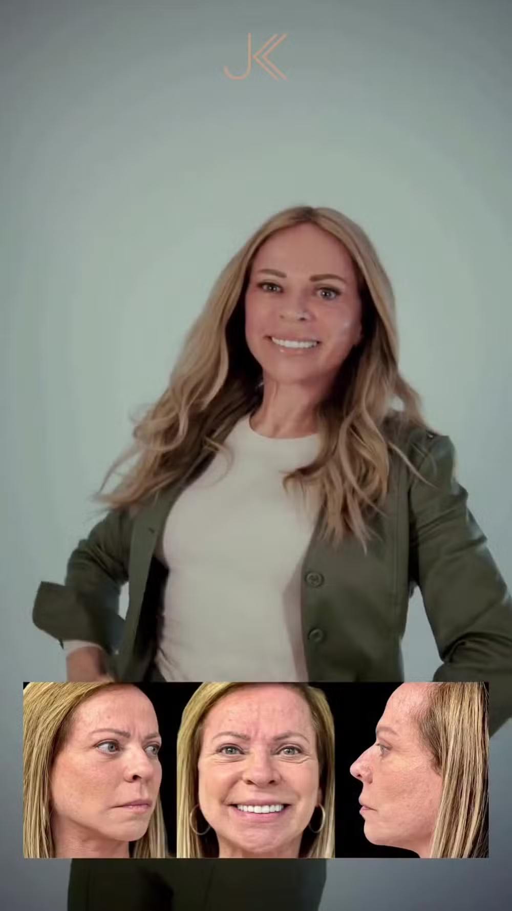 Christina Rocha procedimento Christina Rocha procedimento