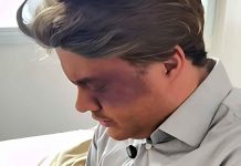 Sertanejo ‘leva chinelada’ após pescaria e precisa dar explicação à esposa: ‘É nisso que dá’