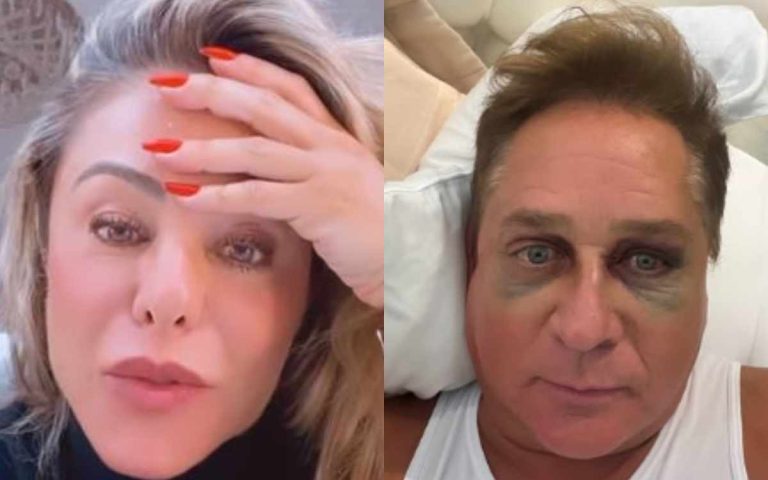Poliana Rocha abre o jogo sobre olho do Leonardo após acidente