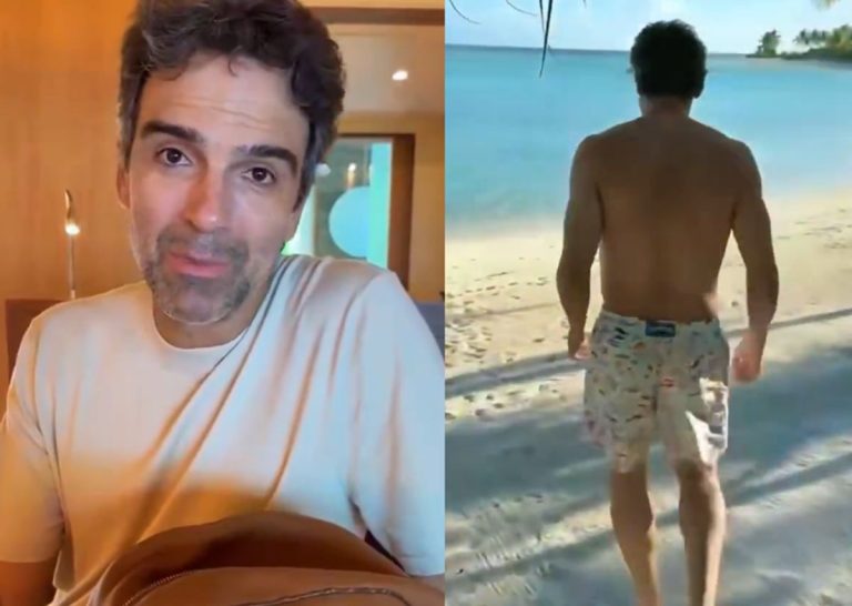 Costas de Tadeu Schmidt chamam atenção nas redes: “Horrores”