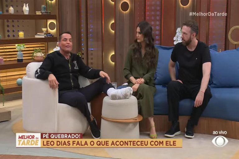 Leo Dias surge machucado ao vivo na Band e dá explicação: “Quebrei alguns ossinhos”