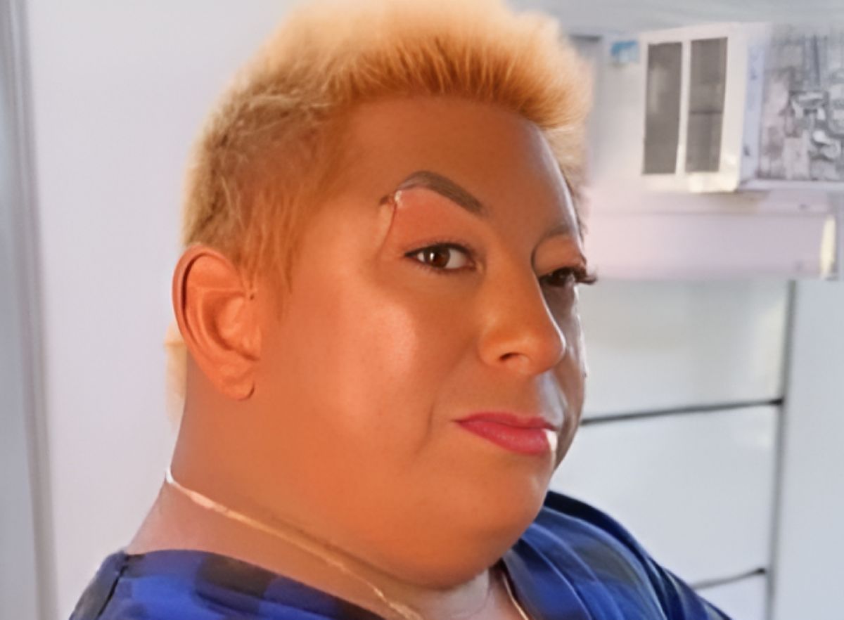 Patixa Teló (Foto: Reprodução/ Redes Sociais)