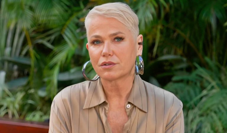 Após diagnóstico, Xuxa passa por transplante e celebra: “Me fazia muito mal”