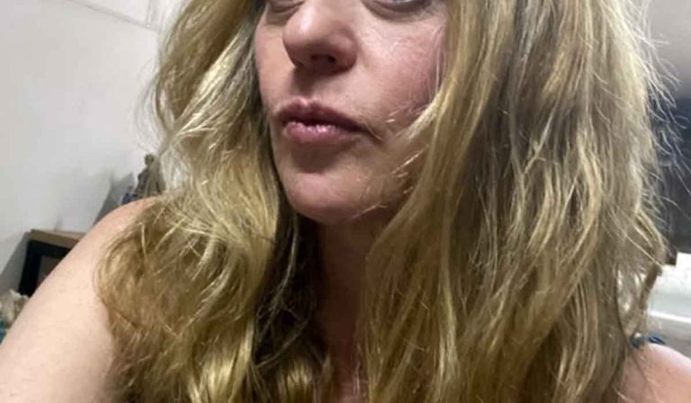 Vida de atriz mudou drasticamente após difícil diagnóstico: ‘Me assustava muito’
