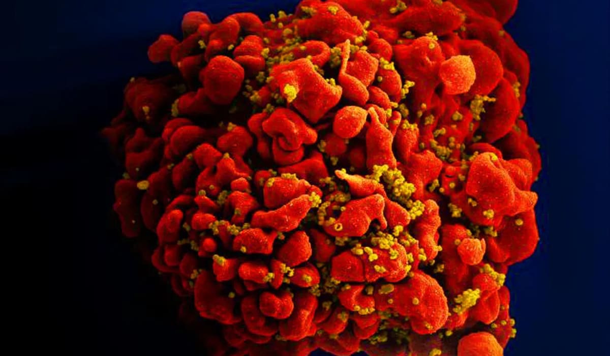 Célula infectada por partículas do vírus HIV, anexas à superfície. — Foto: National Institute of Allergy and Infectious Diseases (NIAID)