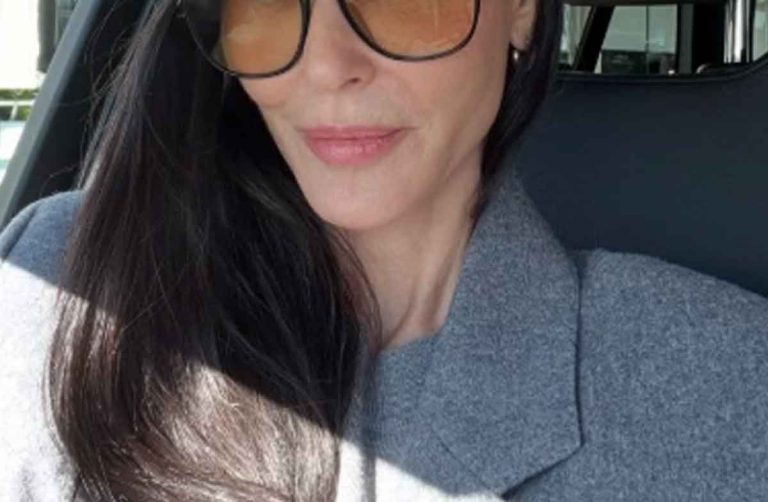 Atriz convive com condição rara e muitos não notaram