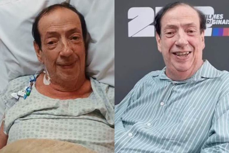Marcos Oliveira, o Beiçola, deixa o CTI após cirurgia