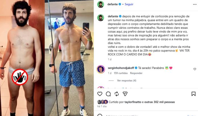 Post de Defante