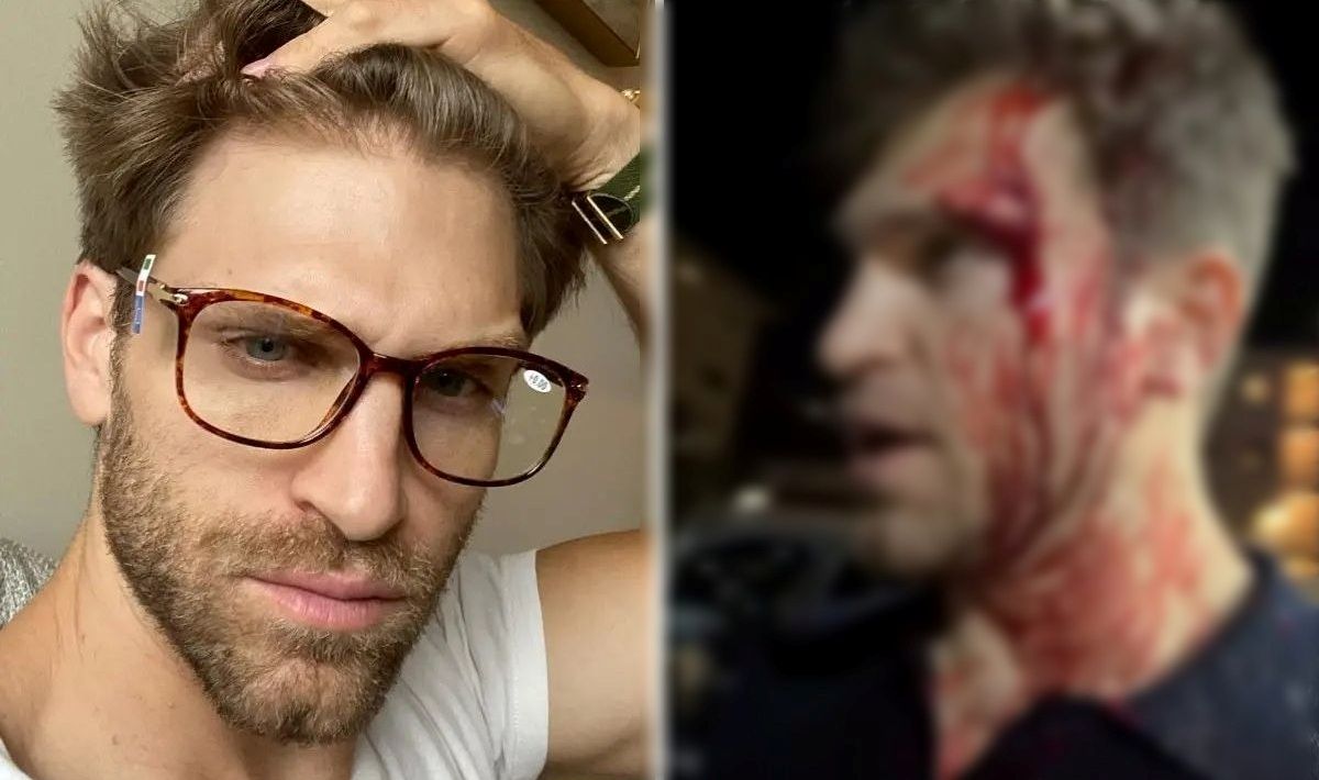 Ator Keegan Allen (Foto: Reprodução/ Instagram @keeoone)