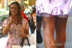 Nicole Bahls passeia em shopping e é clicada com  hematoma na perna